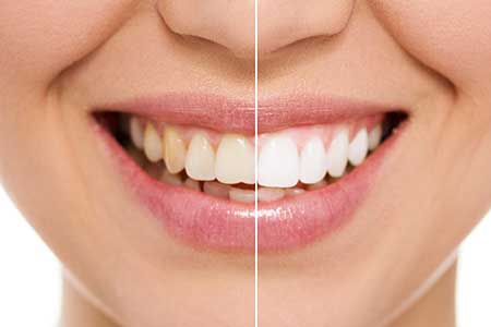 Cosmetic Dentistry near The Pointe