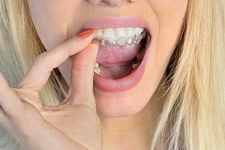 Orthodontics near The Pointe at Lake Norman